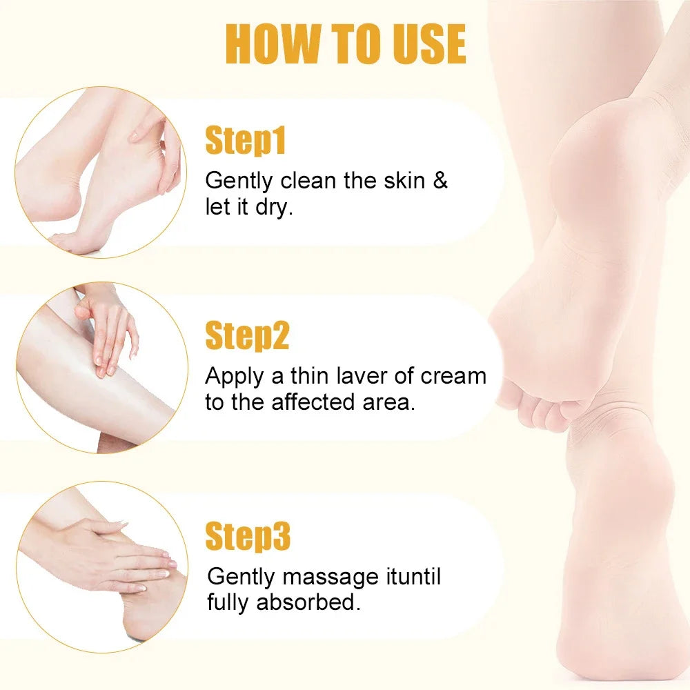 Urea Foot Cream Stick for Dry Cracked Heels & Softening