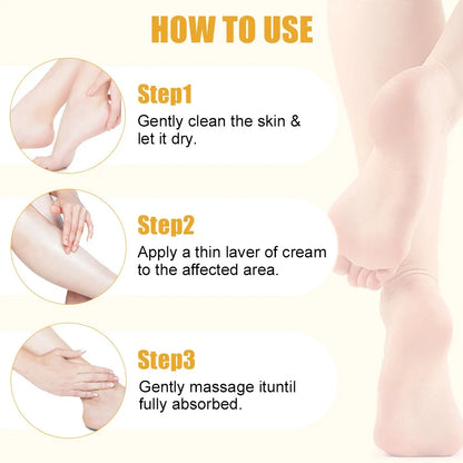Urea Foot Cream Stick for Dry Cracked Heels & Softening