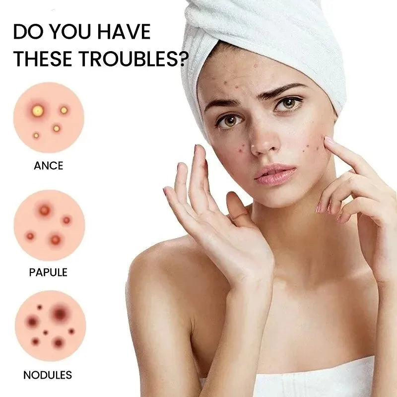 Colorful Star Acne Patches for Pimple Care and Protection