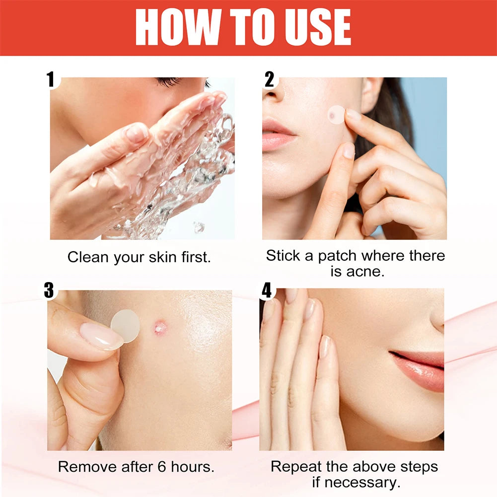 Colorful Star Acne Patches for Pimple Care and Protection