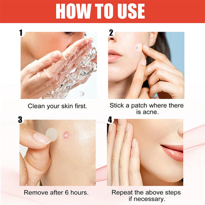 Colorful Star Acne Patches for Pimple Care and Protection