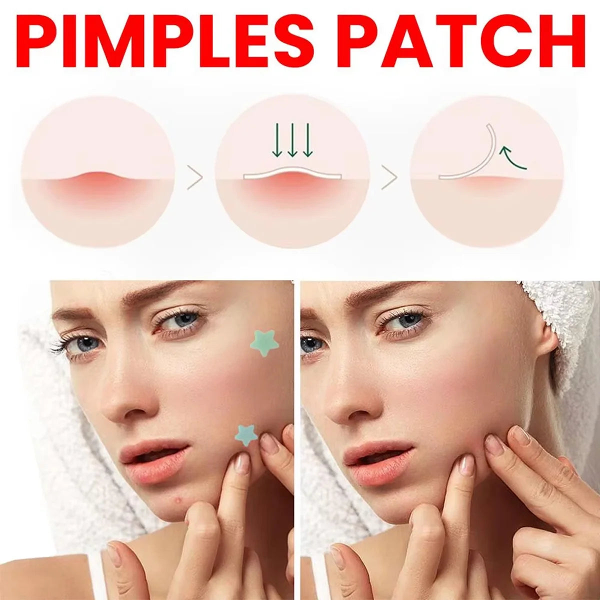 Colorful Star Acne Patches for Pimple Care and Protection