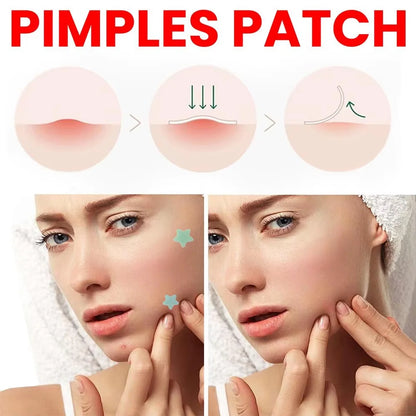 Colorful Star Acne Patches for Pimple Care and Protection