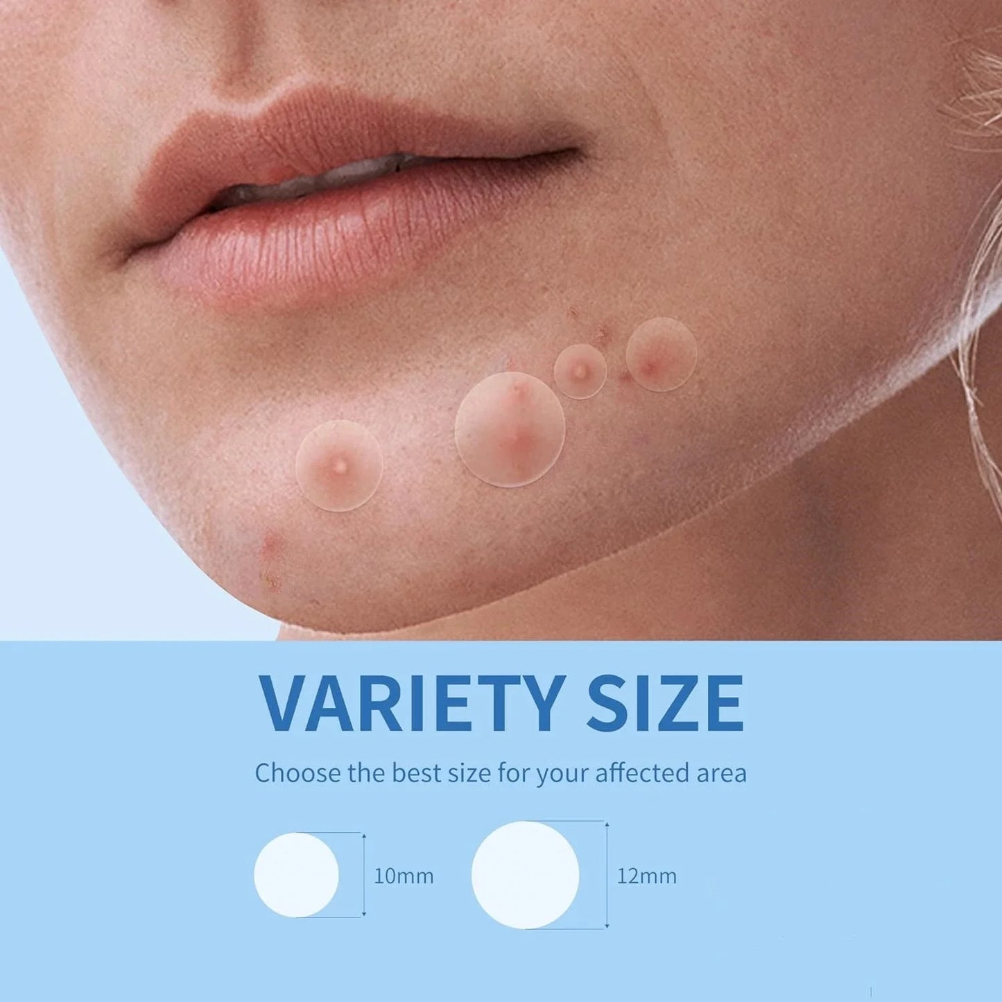 Invisible Acne Patches for Clear, Smooth Skin – 180/360PCS
