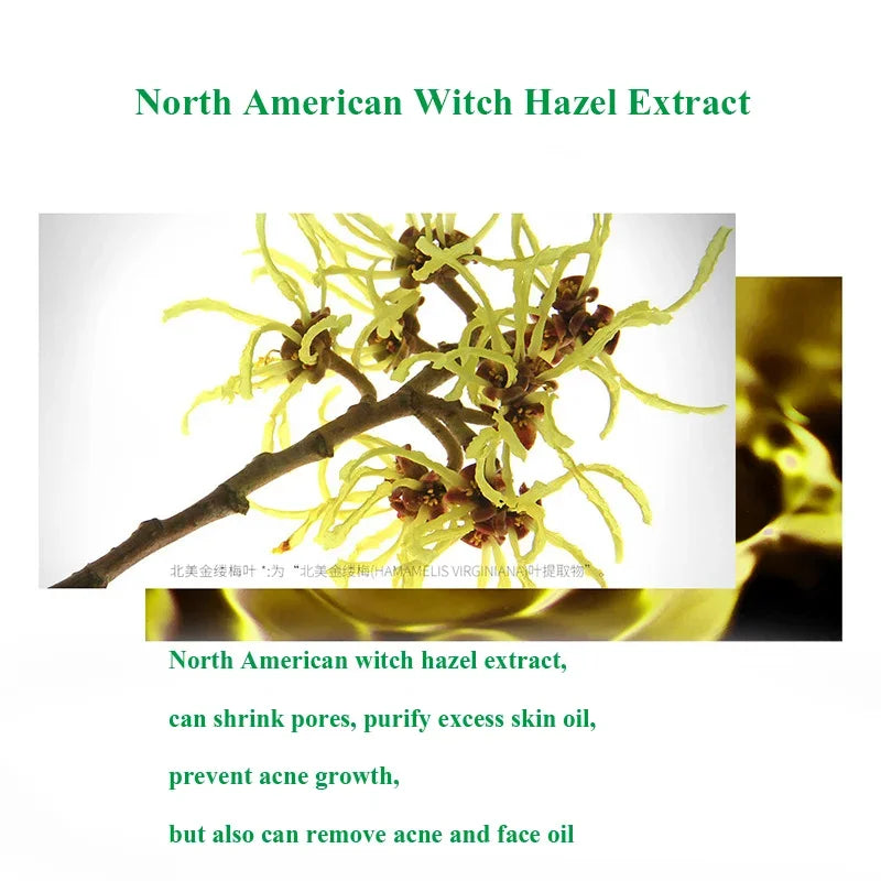 Herbal Acne Treatment Cream for Clear, Smooth Skin