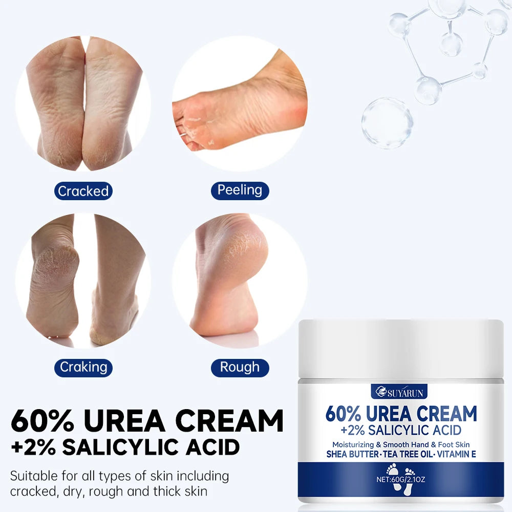 60% Urea Foot Cream for Cracked Heels & Dry Skin Repair