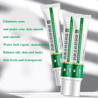 Herbal Acne Treatment Cream for Clear, Smooth Skin