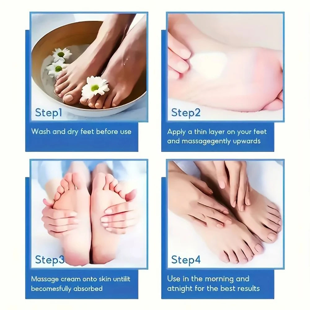 60% Urea Foot Cream for Cracked Heels & Dry Skin Repair